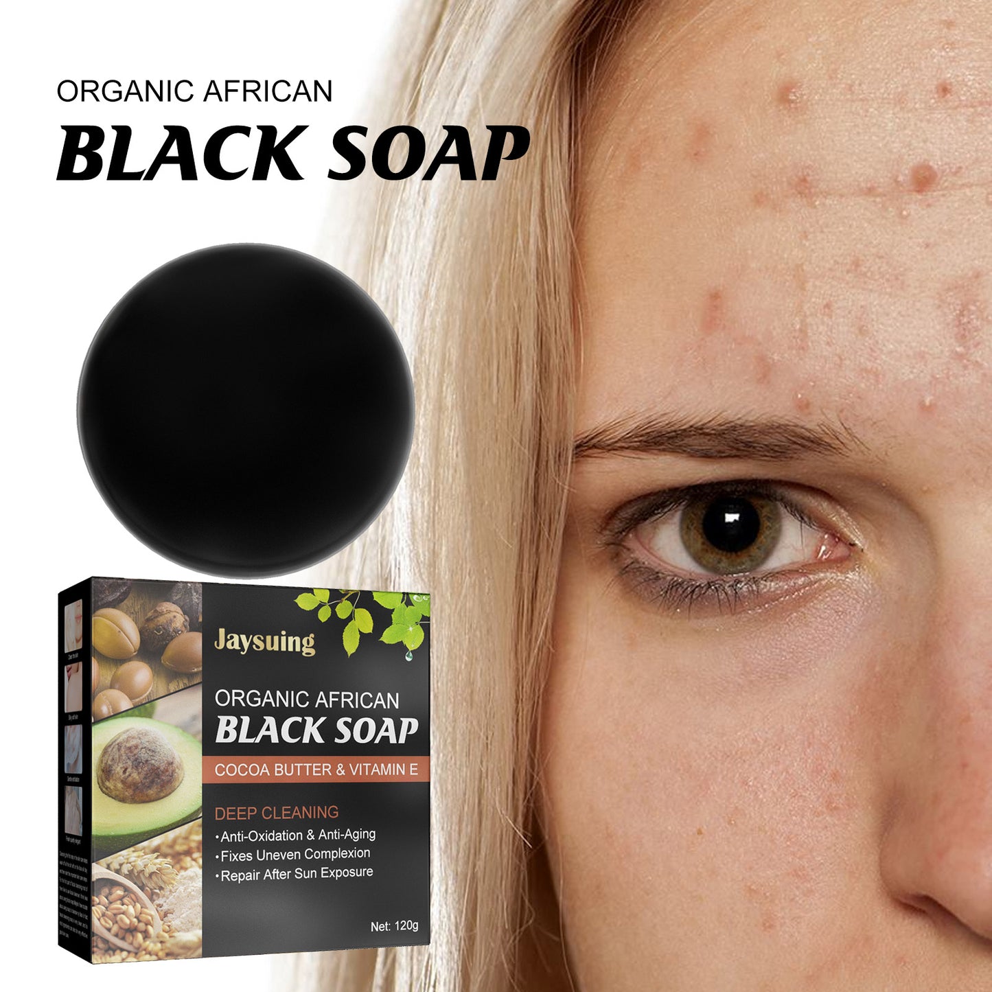 Jabón Facial y Corporal Antiacné | Limpieza Suave · Cuidado Natural de Espalda · Extracto de Aguacate y Macadamia · 120g